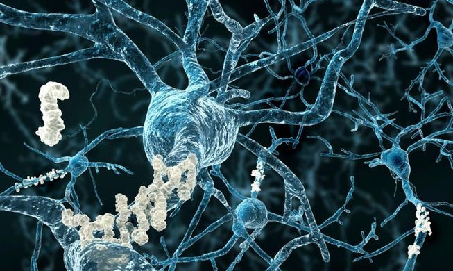 Http   www.cherencov.com salud wp content uploads 2017 08 Principales causas s%C3%ADntomas y tratamientos de la enfermedad de Alzheimer